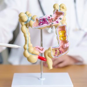 Malattie intestino, attenzione a flora batterica per star bene con gusto