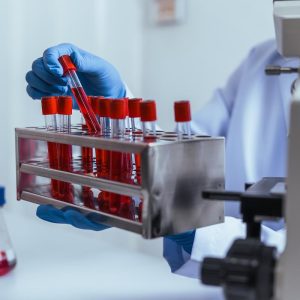 Sangue, cresce raccolta plasma ma Italia non ancora autosufficiente